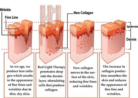 Red Light Therapy For The Skin 4 Astonishing Proven