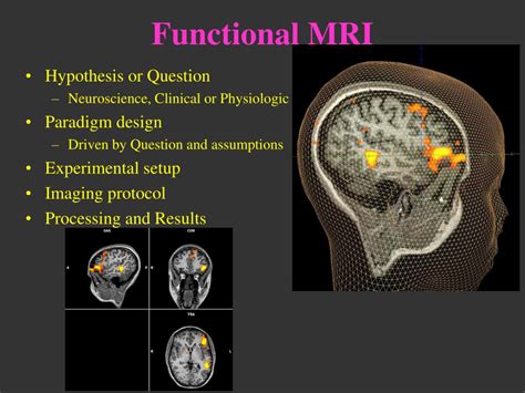 Ppt Functional Mri 101 Powerpoint Presentation Free Download Id