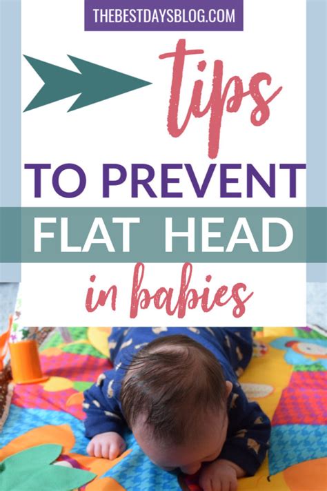 5 Tips To Prevent Flat Head In Babies The Best Days