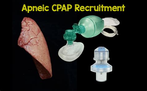 Apox Apneic Cpap Recruitment Rebel Em Emergency Medicine Blog