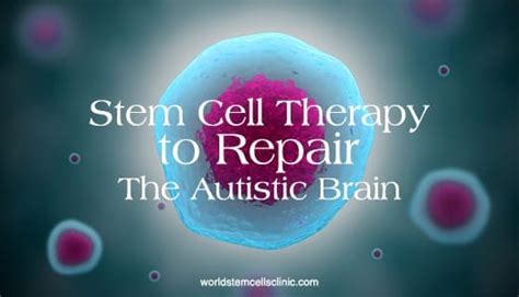 Stem Cell Therapy To Heal The Autistic Brain World Stem Cells Clinic
