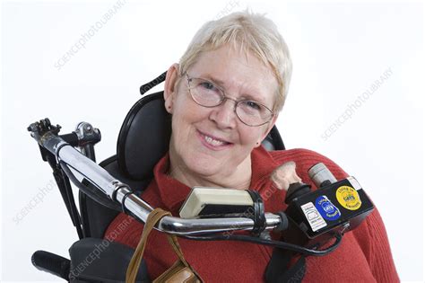 Portrait Of A Woman With Cerebral Palsy Stock Image C0467183