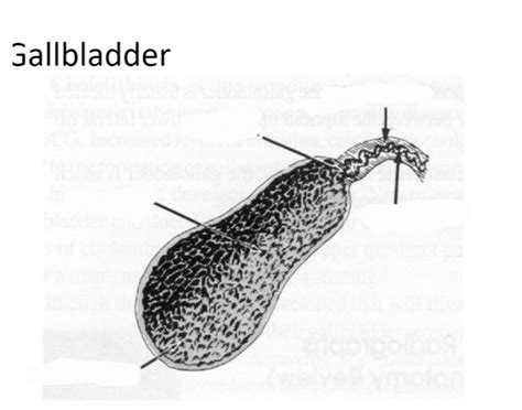 Gallbladder Quiz