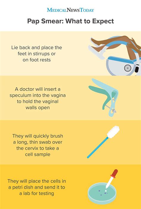 Pap Smear Procedure Steps