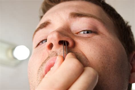 Nebezpečí Vytrhávání chloupků z nosu očima lékaře