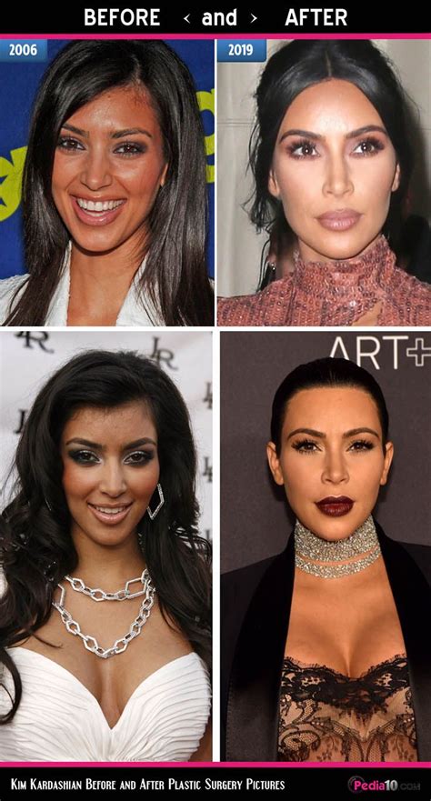 kim kardashian face pics plastic surgery before and after photo 8 kim kardashian before