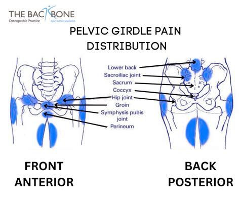 Pelvic Pain In Pregnancy