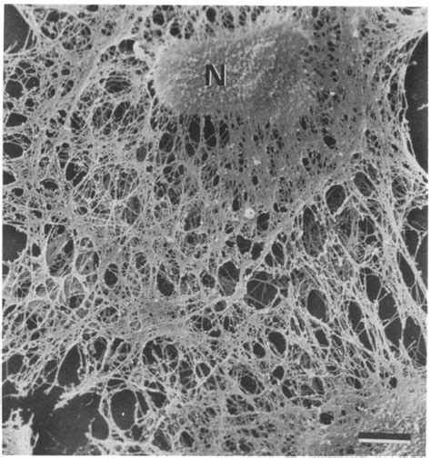 Scanning Em Of A431 Cytoskeleton A431 Cytoskeletons Were Isolated Download Scientific Diagram