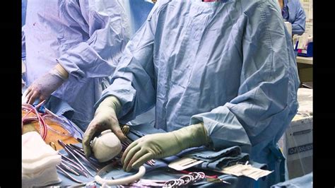 UW Medicine Patient Gets Total Artificial Heart Implant UW Medical Center YouTube