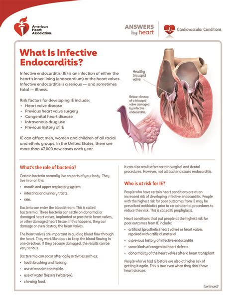 Text What Is Infective Endocarditis Healthclips Online