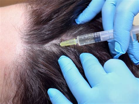 Prp Hair Restoration Therapy All Natural And Non Invasive Procedure At Dr Revive Iv Therapy