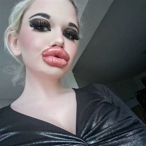 Andrea emilova ivanova, from sofia, bulgaria, has spent thousands of pounds at aesthetic clinics injecting fillers into her. Andrea Ivanova: Die Frau mit den größten Lippen der Welt ...