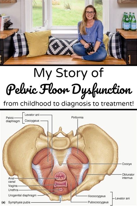 Hypertonic Pelvic Floor Muscle Dysfunction The Floors