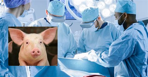 Medical Marvel Pig To Human Organ Transplant Creates New History