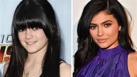 You can see how drastic the change on her look by seeing the before and after picture. Kylie Jenner Before And After - Check Out The Youngest ...