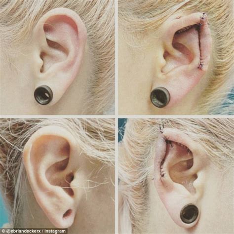 Pixie Ear Modification Real Elf Ear Surgery Ear Pointing Body Mods Youtube Piercings Are No