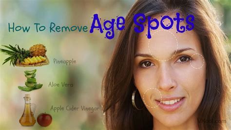 How To Remove Age Spots At Home Naturally 8 Tips