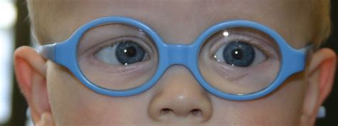 How To Assess Eyes And Vision In Infants And Preschool Children The Bmj