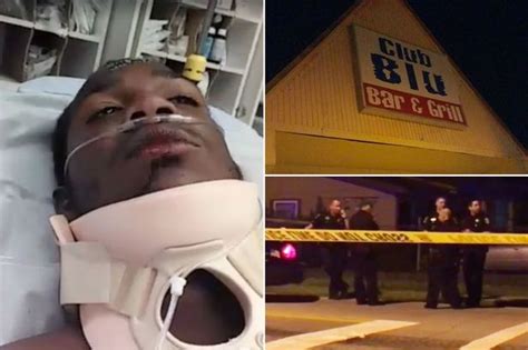 Wannabe Rapper Shoots Himself In The Face To Get Famous In Shocking