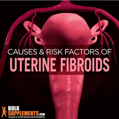 What Are Uterine Fibroids Symptoms Causes Treatment