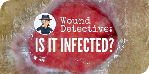 In a similar vein, applications that won't run or files that won't open may also be the result of infection. Wound Detective Series: Is It (Or Is It Not) Infected ...