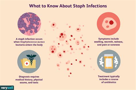 Staph Infection Overview And More
