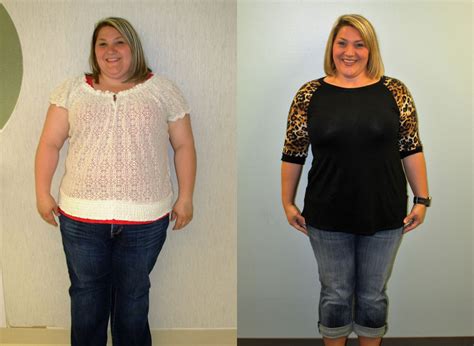 Ashleys Weight Loss Transformation St Louis Bariatrics