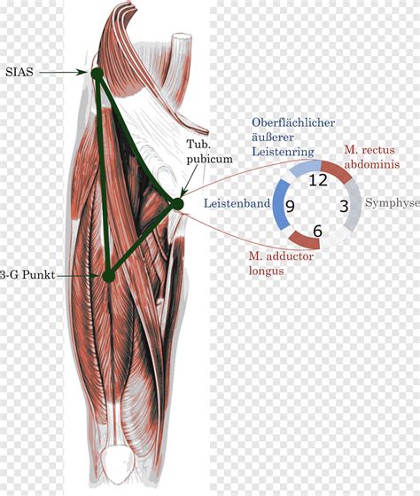 It is often referred to as a 'pulled groin muscle', or a 'groin pull'. Groin Muscle Anatomy - Clinical Anatomy Of The Pelvis And Hip Reumatologia Clinica / Groin ...