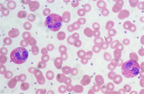 White Blood Cells With Pictures Physician Assistant