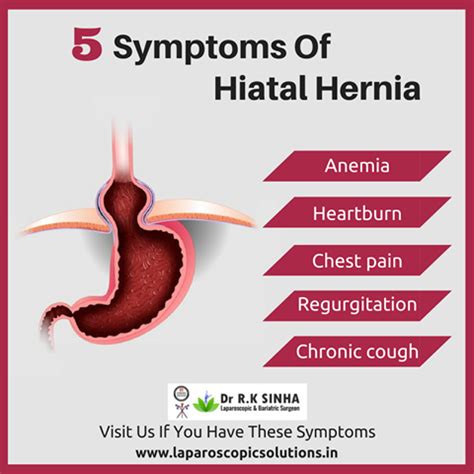 This type of hernia can be asymptomatic but it is often related to reflux symptoms. Hiatal hernia repair| Hernia operation Mumbai| India
