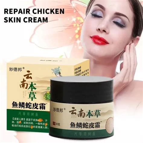 Curing Keratosis Pilaris Chicken Skin Body Lotion Skin Cream Skin