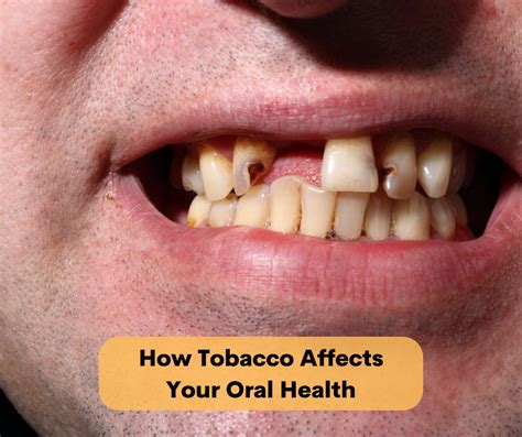 how tobacco affects your oral health altoona ia altoona smiles