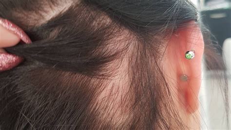Traction Alopecia How To Prevent And Fix It Allure