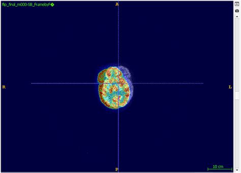 Difference Between Imposed Motion Simpleitk And Registration Output