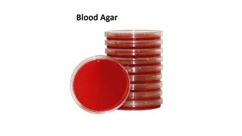 Blood Agar Composition Preparation And Uses Online Biology Notes