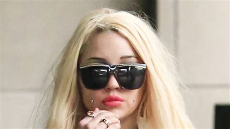 Amanda Bynes Reveals All About Her Plastic Surgeries My Xxx Hot Girl
