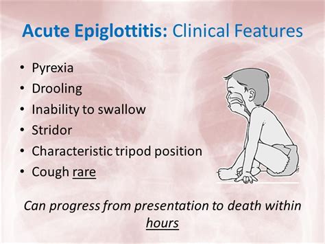 Mytest 17 Tripod Position Child Epiglottitis