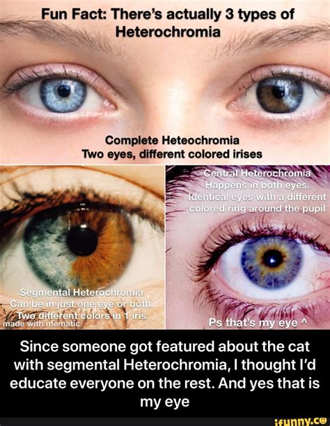 Fun Fact Theres Actually Types Of Heterochromia Complete Heteochromia Two Eyes Different