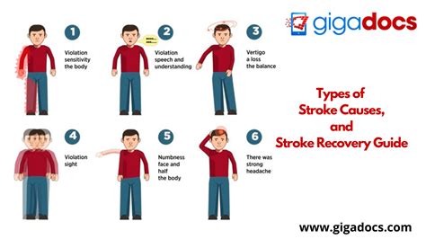Addressing Types Of Stroke Causes And Stroke Recovery Guide Gigadocs
