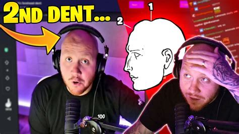 Timthetatman Has A Second Dent In His Head Youtube