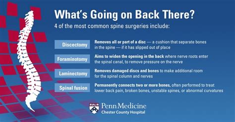 The Truth About Spine Surgery 5 Myths Debunked Chester County