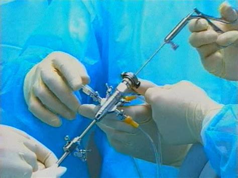 Pain Management For Back Pain Injections Herniated Disk Surgery
