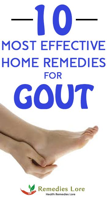 10 Most Effective Home Remedies For Gout Remedies Lore