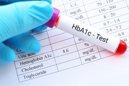 Hba1c (glykohämoglobin) ist roter blutfarbstoff, der an glukose gebunden ist. HbA1c-Normalwert und Bedeutung als Laborwert für Diabetiker