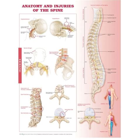 Anatomy And Injuries Of The Spine Anatomical Chart Soft Laminate