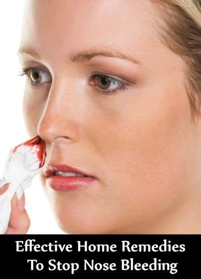 10 Effective Home Remedies To Stop Nose Bleeding Natural Home