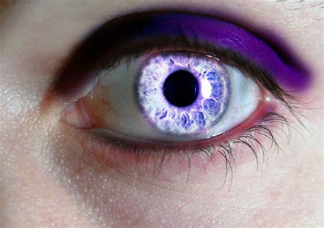 An Eye With Blue And Purple Colors On Its Iris Is Seen In This Close