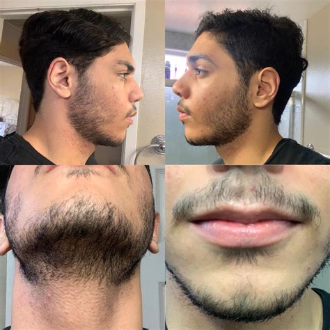 24 Days Growth Decided To Grow My Facial Hair How Much More Will I