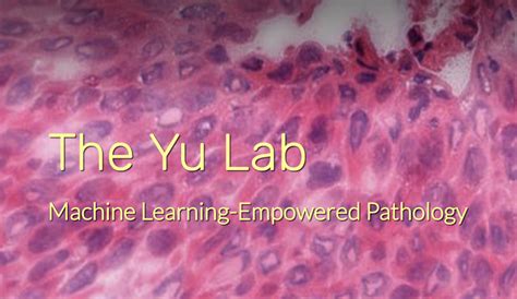 Yu Lab Department Of Biomedical Informatics