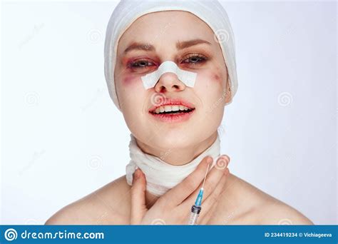 Portrait Of A Woman Facial Injury Health Problems Bruises Pain Close Up